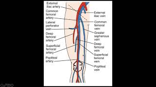 Lower Extremity Deep Venous Thrombosis DVT [upl. by Elconin]