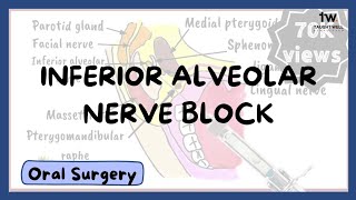 Inferior Alveolar Nerve Block Technique [upl. by Kravits]