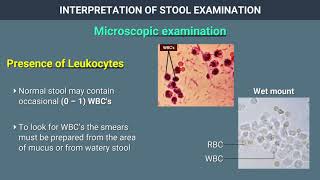 Interpretation of Stool Examination [upl. by Theo]