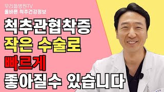 척추관협착증 작은 수술로 빠르게 좋아질 수 있습니다  우리들병원TV [upl. by Joub]