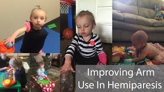 Improving Arm Use In Hemiparesis [upl. by Azmah958]