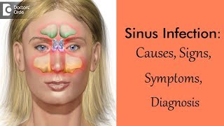 What are the symptoms of sinusitis [upl. by Elias602]