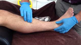 Dry Needling Extensor Digitorum Longus [upl. by Hittel470]