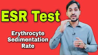 ESR Test  Erythrocyte Sedimentation Rate  High ESR Causes [upl. by Kcirtap740]