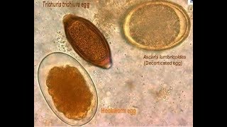 parasites seen from the microscope [upl. by Maddis]