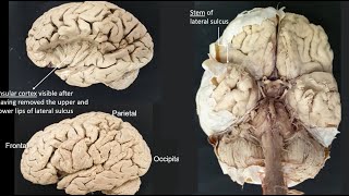 Lateral sulcus [upl. by Otiv]