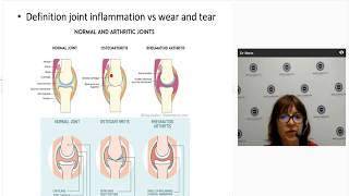 How do you treat Psoriatic Arthritis An Overview [upl. by Law]