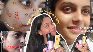 Brutally Honest CureSkin Review My Shocking Experience 😱😨 [upl. by Naimerej900]