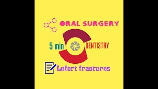 LEFORT FRACTURE LINES  ORAL SURGERY [upl. by Savart]