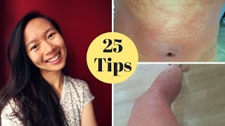 HOW I CURED MY ECZEMA [upl. by Vincents175]