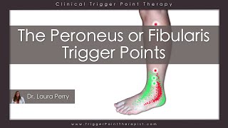 The Peroneus or Fibularis Trigger Points [upl. by Hansen]