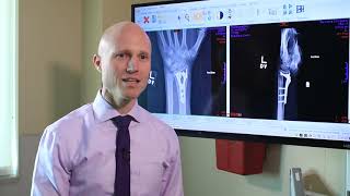 Broken Wrists Fracture Types Treatment Options amp Recovery  Dr Froelich [upl. by Aettam]