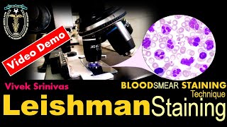 LEISHMAN STAINING  Blood Smear Staining Technique  Microbiology  Vivek Srinivas  Bacteriology [upl. by Olrac]