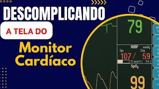 Interpretando a Tela do Monitor Cardíacoenfermagemnasctreinamentosenfermagem [upl. by Carpio]