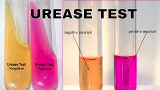 Urea Hydrolysis Urease Test [upl. by Nnybor43]