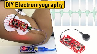 What are EMG and EP  Neurosoft Webinar «EMG for Beginners» [upl. by Betteann]