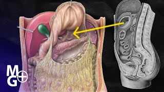 BURSA OMENTALA Prezentare Anatomie [upl. by Castle]