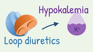 How diuretics cause hypokalemia [upl. by Nerta]