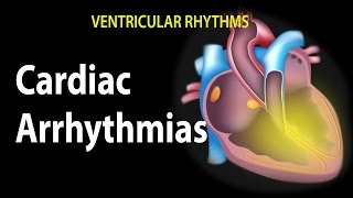 Cardiac Arrhythmias Animation [upl. by Neelyak]