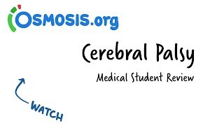 Cerebral Palsy  Clinical Review [upl. by Norby468]