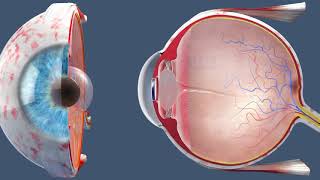 Cataract Surgery  Inside the OR [upl. by Beatty]