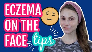 Eczema on the face 11 tips from a dermatologist Dr Dray [upl. by Ydnys]