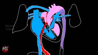 Fetal Circulation  Anatomy  Made easy  3 minutes [upl. by Winnifred]