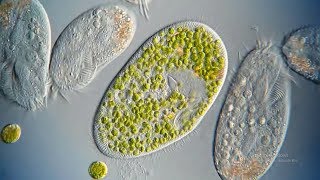 What are Ciliates [upl. by Hiller]