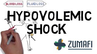 Hypovolemic shock  Introduction amp Causes [upl. by Pierrette]