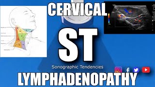 Sonoquickies  Cervical Lymphadenopathy [upl. by Spancake]