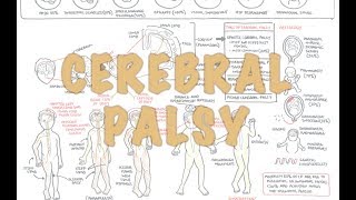 Cerebral Palsy  DETAILED Overview [upl. by Nayar821]