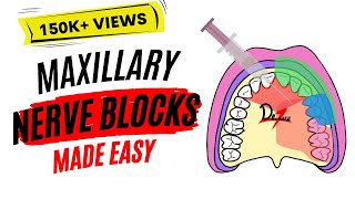 Maxillary Nerve Block Anesthesia For Dental Procedures [upl. by Nehcterg93]