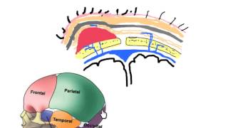 scalp hematomas in neonates [upl. by Erdua]