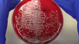 Plate Reading  Urine I [upl. by Chaudoin101]