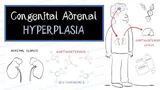 What is Congenital Adrenal Hyperplasia CAH [upl. by Paxon]