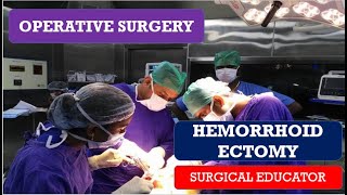 HEMORRHOIDECTOMYSTEP BY STEP OPERATIVE SURGERY [upl. by Cornie]