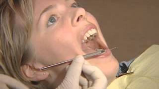 Mandibular Anesthesia  GowGates Block [upl. by Quartis62]