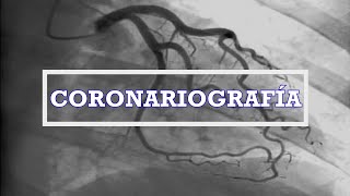 Coronariografía y Proyecciones Angiográficas [upl. by Leahcin225]