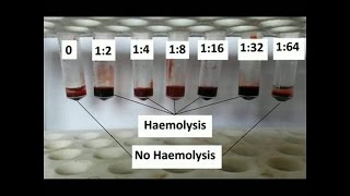 How to Determine antibody titer [upl. by Jobe]