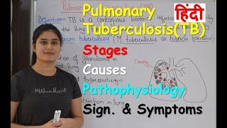 Pulmonary Tuberculosis in Hindi  Stages  Causes  Pathophysiology  Sign amp Symptoms [upl. by Einapets]