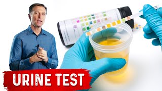 Urine Test Simplified [upl. by Schiff]