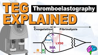 TEG Explained  Understanding the Thromboelastography [upl. by Asilenna22]