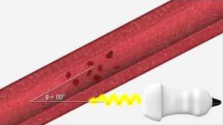 Ultrasound Physics  Explaining Doppler [upl. by Layne59]