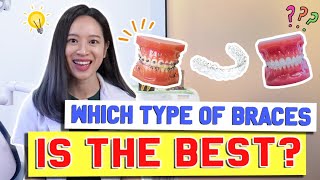 Types of Braces COMPARED amp EXPLAINED  BraceYourself🦷 [upl. by Lleryt]