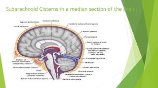 Subarachnoid Cisterns – Anatomy [upl. by Armilda]