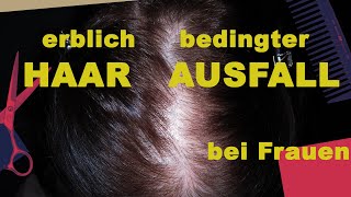 Erblich bedingter Haarausfall bei Frauen [upl. by Annoif214]