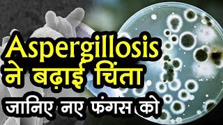 Aspergillosis infection से किसे है खतरा कैसे हो सकता है बचाव [upl. by Anyehs974]