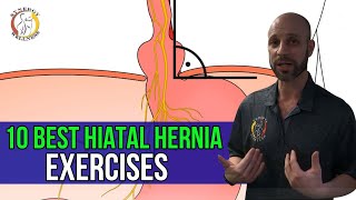 10 Best HIATAL HERNIA Exercises [upl. by Adine]