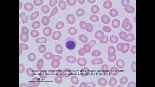 Classificação de Leucócitos [upl. by Enelram]