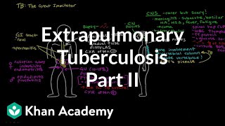 Extrapulmonary TB Part 2  Infectious diseases  NCLEXRN  Khan Academy [upl. by Iyre]